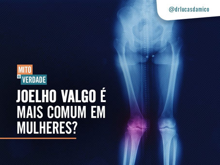 Mito ou verdade: joelho valgo é mais comum em mulheres?