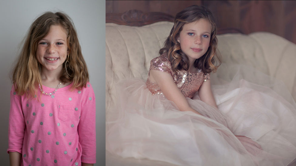 before and after photo of a young girl
