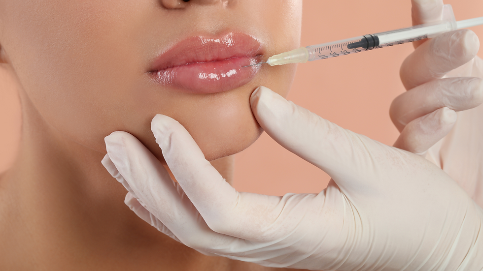 Preenchimentos com Ácido Hialurônico em Boca e Sulcos Nasogenianos