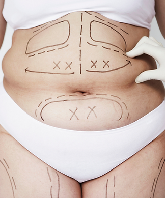 paulo-bettes-cirurgia-plastica (26).png