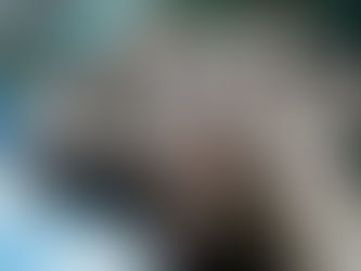 Cirurgia das Pálpebras (Blefaroplastia)