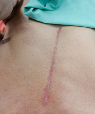 paulo-bettes-cirurgia-plastica (24).png