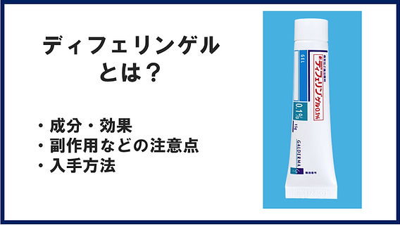 ディフェリンゲル（アダパレン）とは？ニキビ治療効果、購入・入手方法 