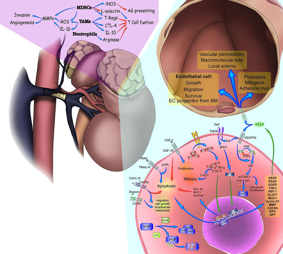 Inflammation in Kidney Cancer