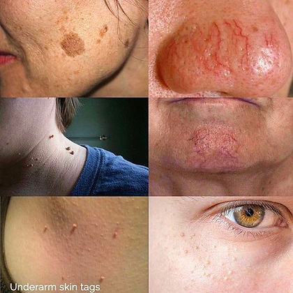 Skin Irregularities.jpeg