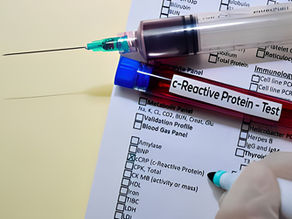How much CRP Level is Dangerous?