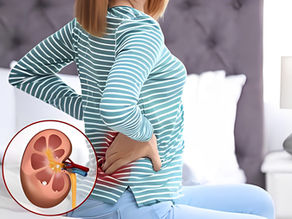 Can Stress Cause Kidney Stones?