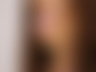 Swollen Tongue: Causes, Symptoms, and Treatment