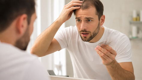 How to stop hair fall : हेयर लॉस (बाल झड़ना): कारण, इलाज, रोकथाम और हेल्दी बालों के लिए एक्सपर्ट टिप्स