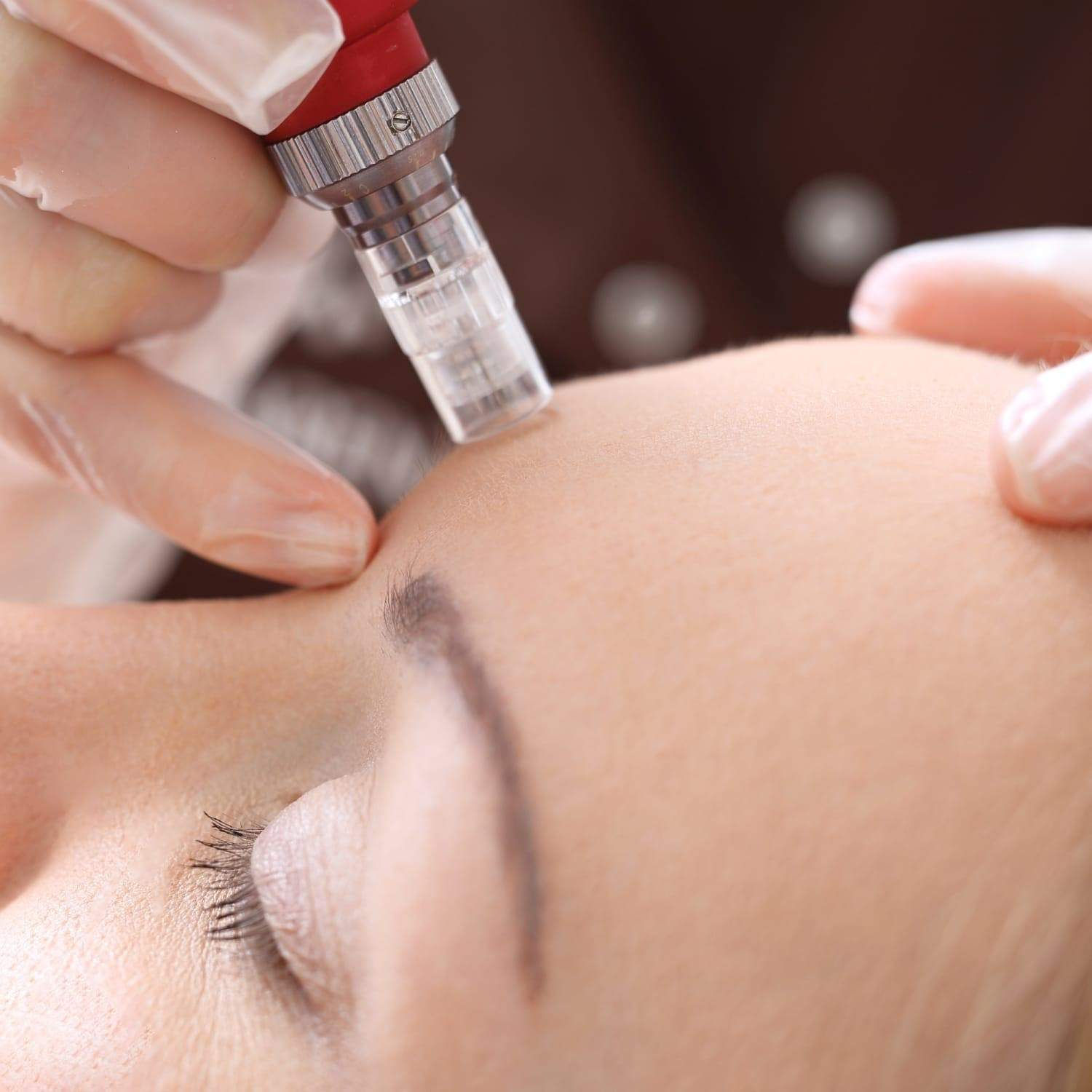 Advance Skincare Micro-needling Online Course