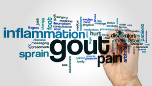 Gout - What is it about?
