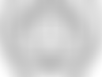 This study beautifully depicts symptom overlap between MCAS/POTS and Hypermobility Syndrome