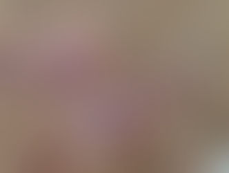 Cuidado com esta praga | Watch out for this plague