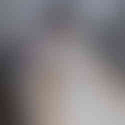 Camila vive sob cuidados