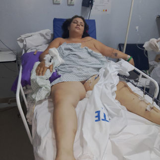 Camila vive sob cuidados