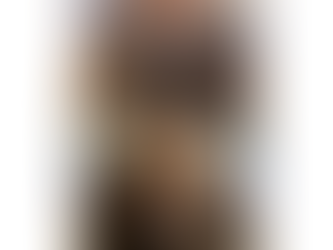 Healing Confidence Through Scalp Micropigmentation: A Solution for Surgical Scars, Alopecia & More