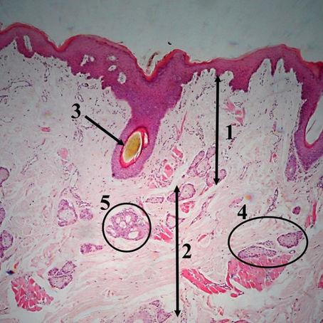 Pele (Fina - Grossa)