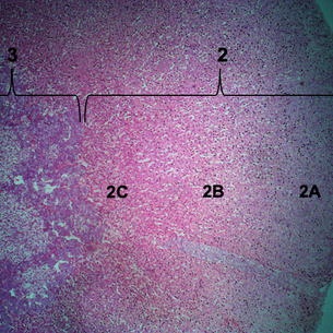 Adrenal