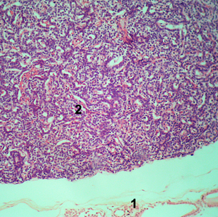 Paratireoide