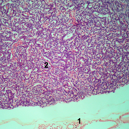 Paratireoide