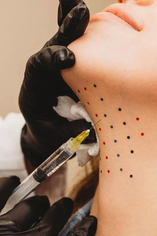 Kybella-featured-image-1.jpg.webp