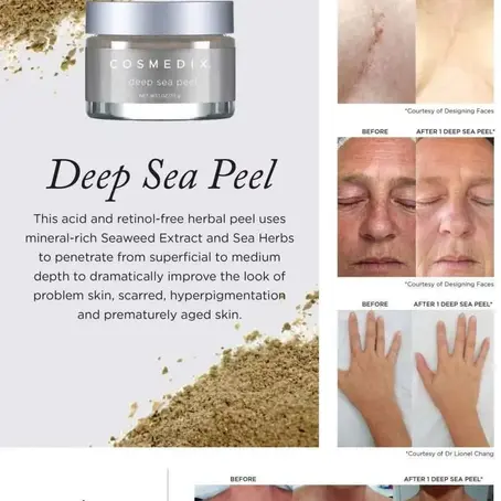 New Treatment at MYOMY Wellness; Just for you! Deep Sea Peel by Cosmedix at a discounted price with a free Led Light treatment for the first 20 Clients to book