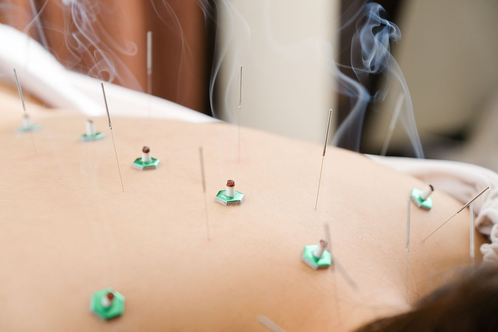 Moxa & Dry Needling