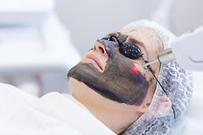 Carbon face peeling procedure. Laser pulses clean skin of the face. Hardware cosmetology t