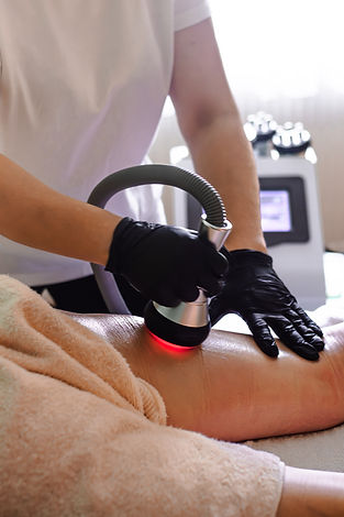 stretch marks on the skin after childbirth and weight loss. RF lifting hardware massage on