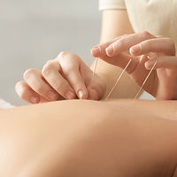 Acupuncture_edited.jpg