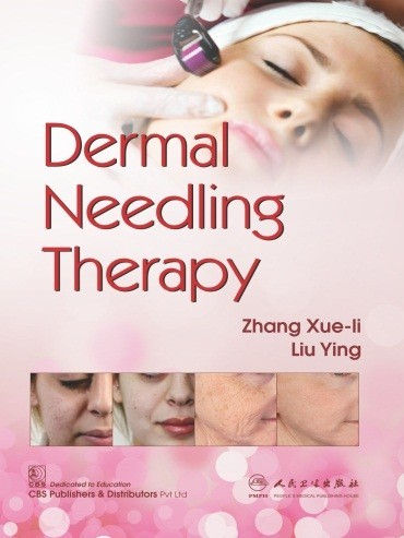 Dermal Needling Therapy Zhang Xue-li Liu Ying