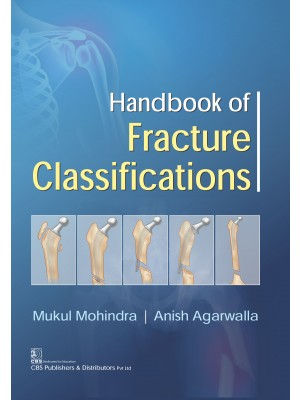 Handbook of Fracture Classifications