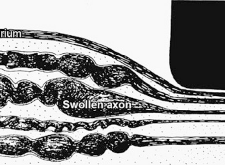 Axonal Transport