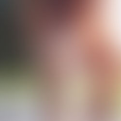 Regeneração do joelho