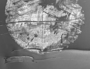 Achtsamkeit als Rettung vom Burnout