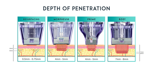 morpheus8-treatment-depths-graphic-preview-1.png