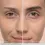 Thumbnail: Obagi Nu-Cil™ Eyebrow Boosting Serum