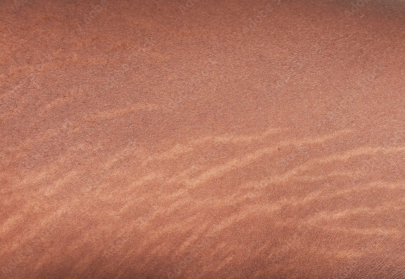 Stretch Mark