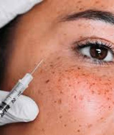luna's medical aesthetic | Dermal Fillers