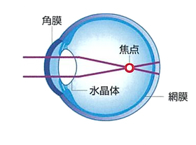 近視
