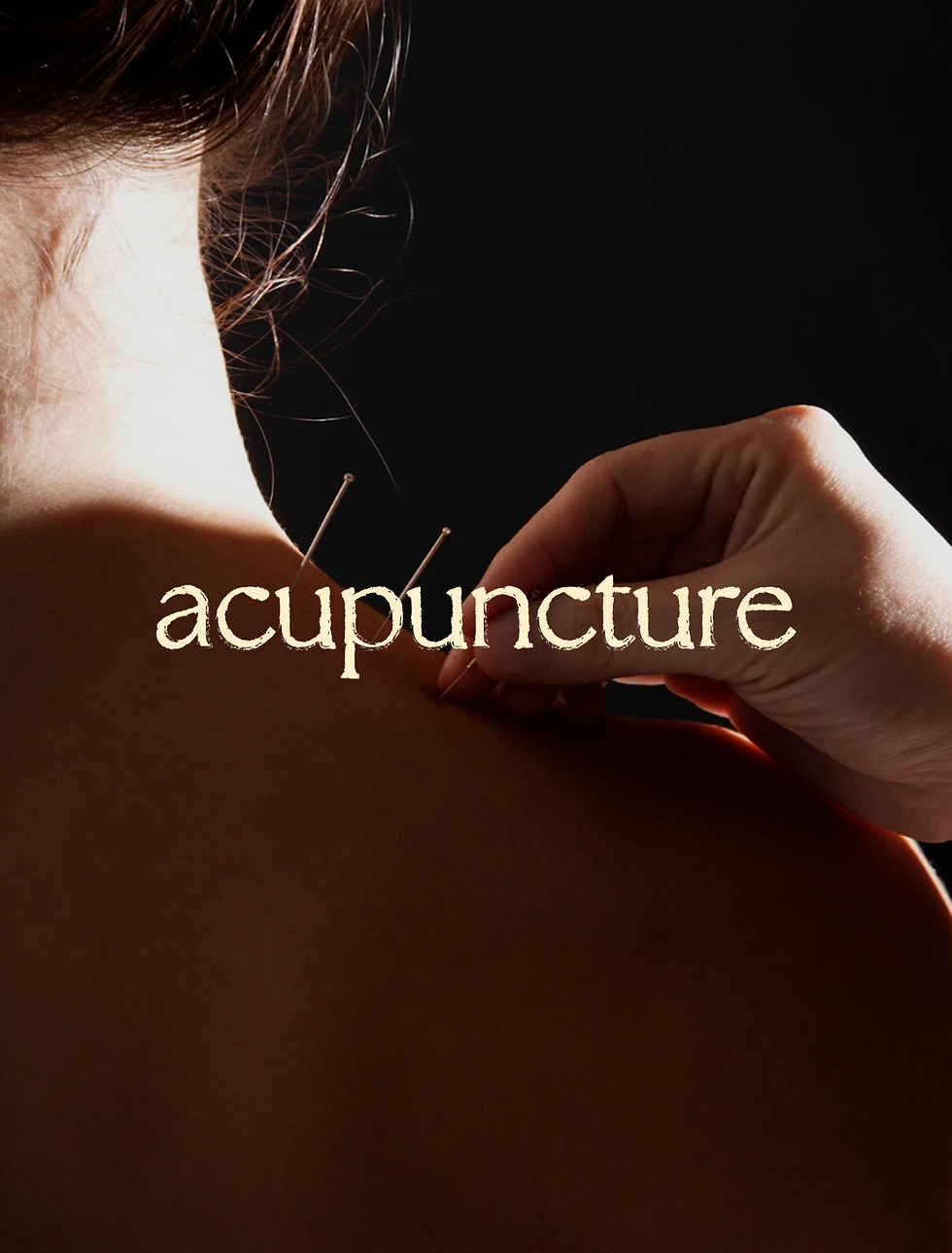 Image_acupuncture.png