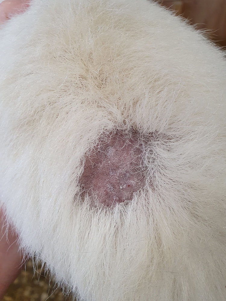 Fungal Infections and Treatment