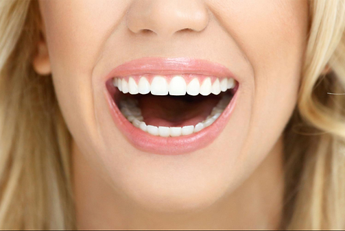 gummy smile makeover by Brighton Dentist Melbourne