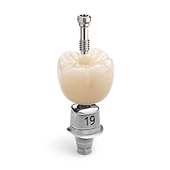 Screw-retained implant crown ready for placement at our Bellevue officeImplant Crown.png
