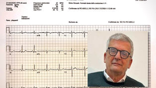 eseguito un elettrocardiogramma con sistema di telemedicina a Longobucco, Cosenza