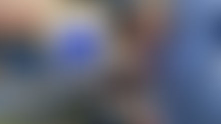 Equipe cardiochirurgica della “Dulbecco” di Catanzaro durante un intervento con mini circolazione extracorporea