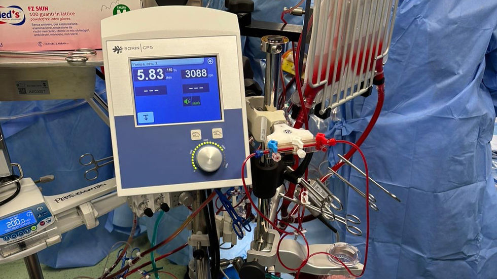 Equipe cardiochirurgica della “Dulbecco” di Catanzaro durante un intervento con mini circolazione extracorporea