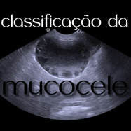 classificação da mucocele