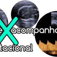 exame gestacional X acompanhamento gestacional