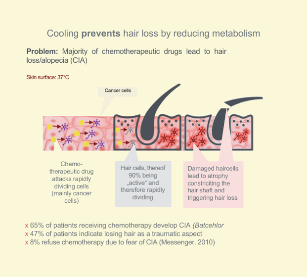 Hilotherapy: Scalp cooling reduces uptake of cytotoxic substances at the hair follicles and thus avoids alopecia